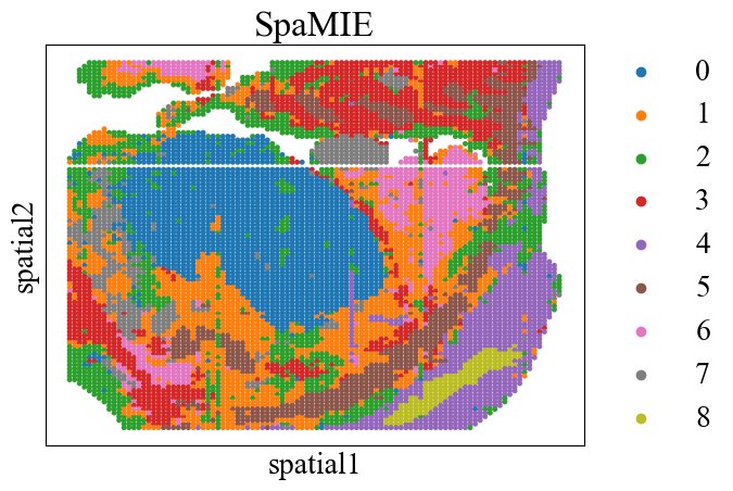 _images/Tutorial_4_data_inputation_and_integration_for_MouseEmbryo_11_3.png